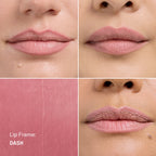 Lip Frame
