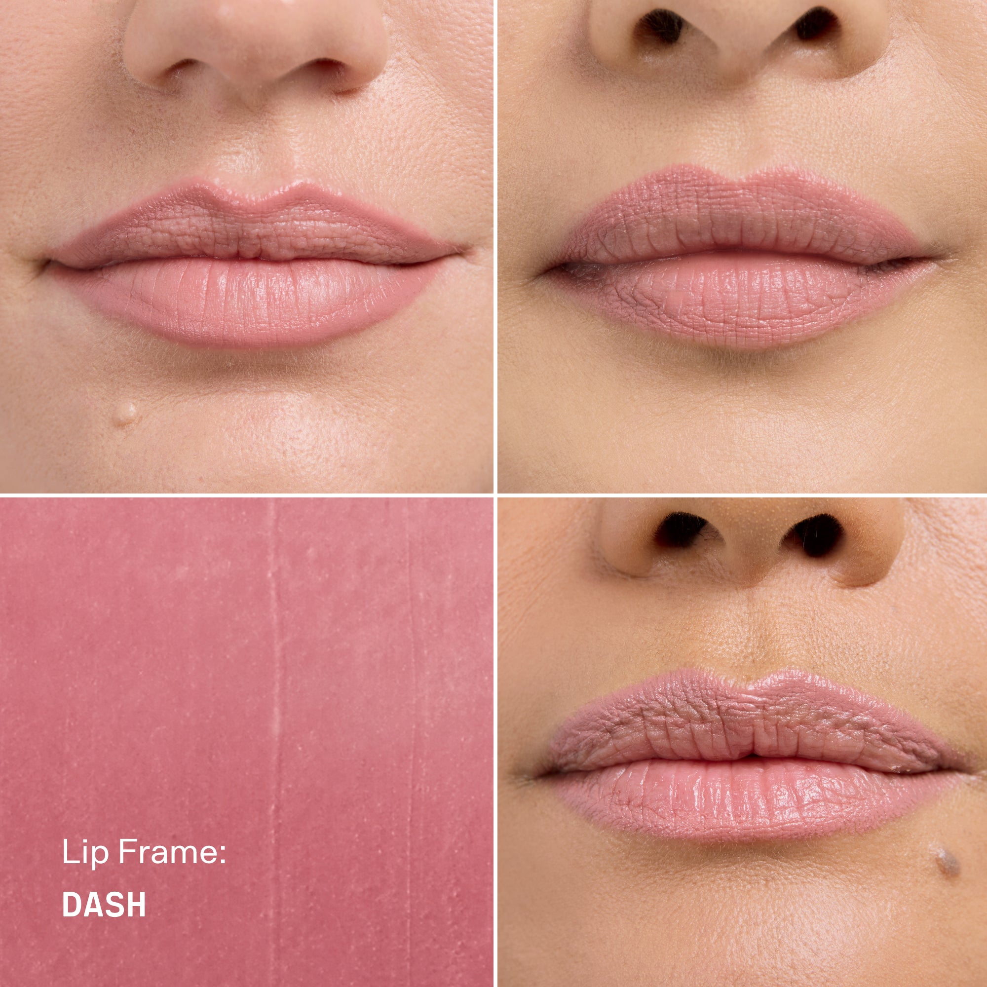 Lip Frame
